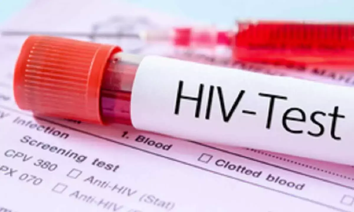 Diagnosed HIV Prevalence To Reach Over 2.2mn In 2033: Report