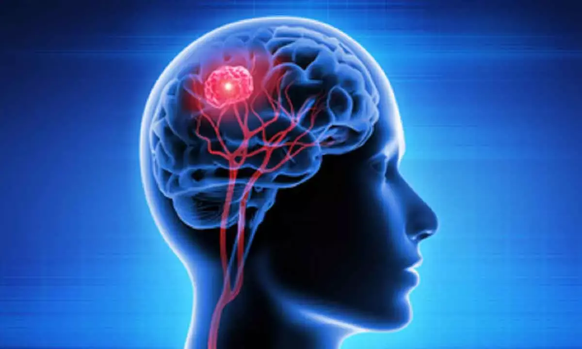 Men More Likely To Die From Brain Injury Than Women: Study