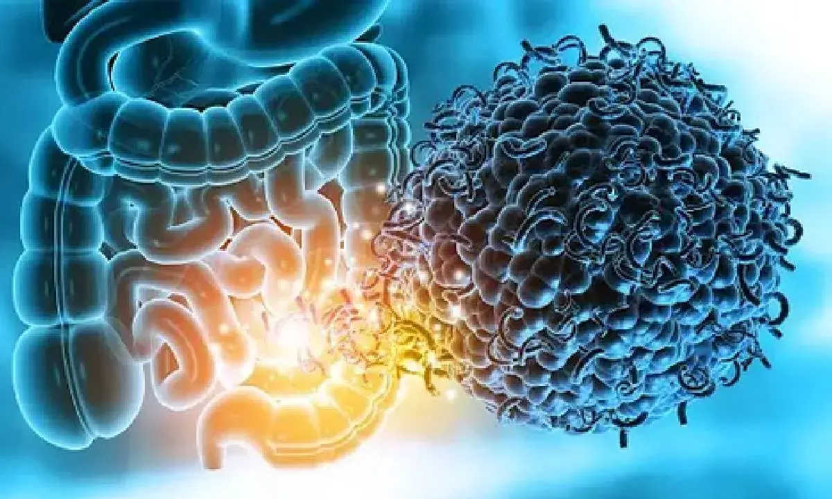 Study shows how gut microbiome raises risk of multiple sclerosis