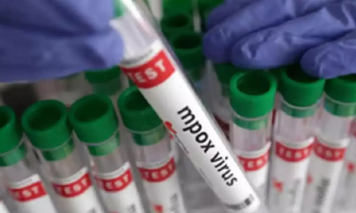 Mpox Clade 1b More Infectious, Says Study