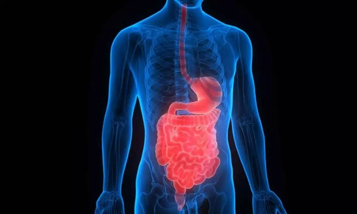 Study Finds Mechanisms That May Lead To Bowel Disease