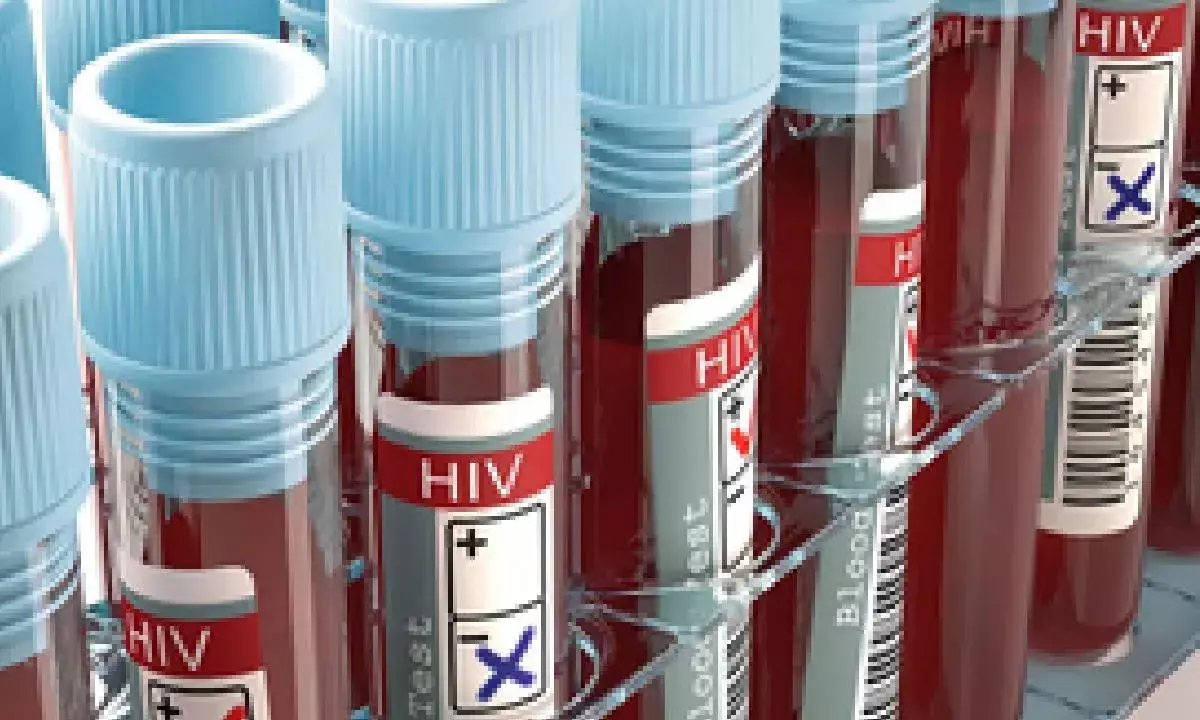 Global HIV funding cuts can cause over 10 mn infections, 3 mn deaths by 2030: Lancet