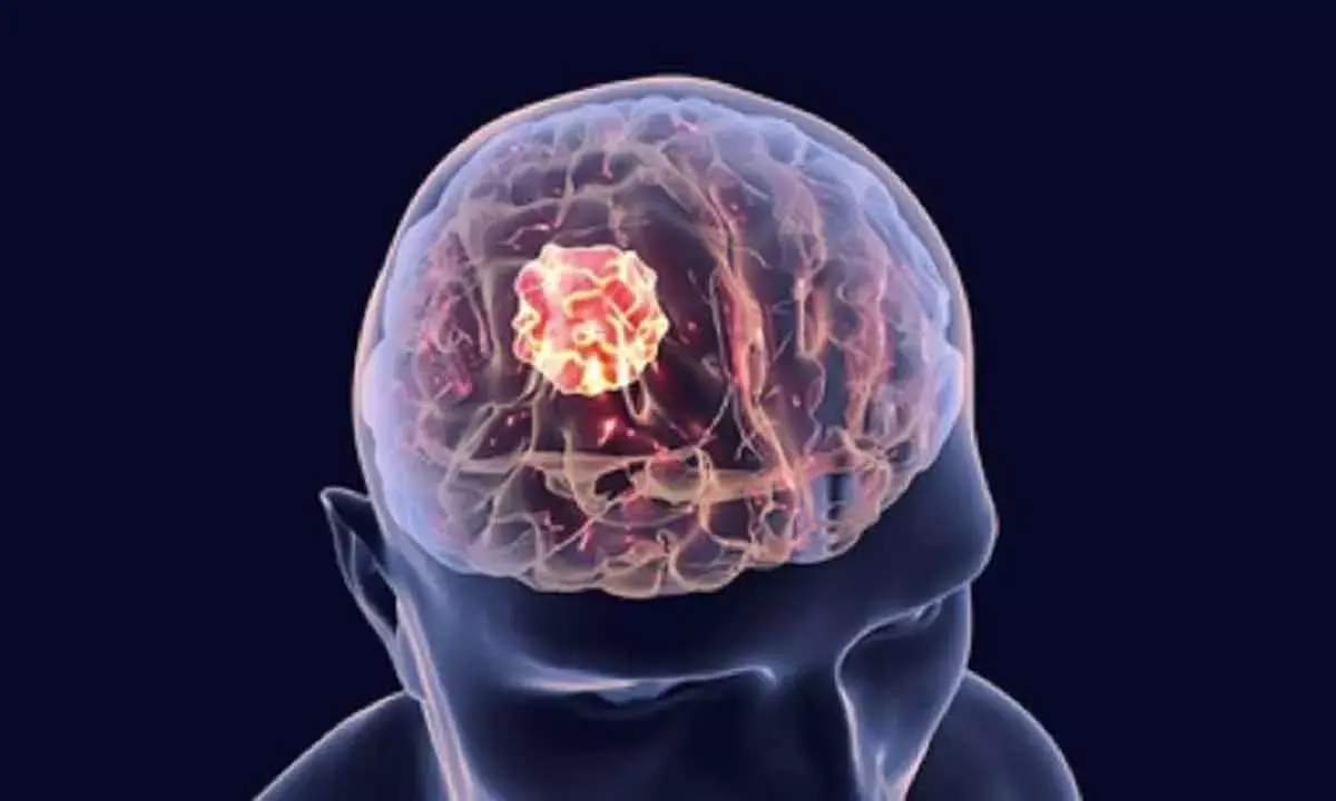 AI Tool Developed To Decode Cell Responses To Drugs