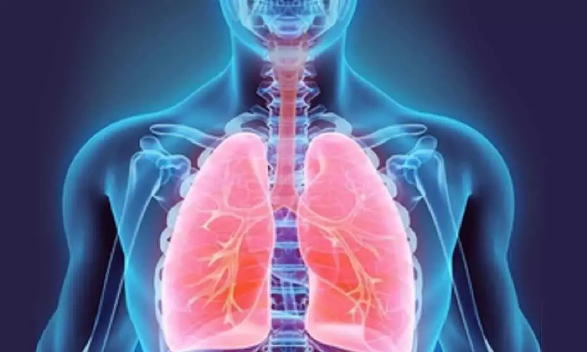 One in 3,000 At Risk Of Deflated Lung From Faulty Gene
