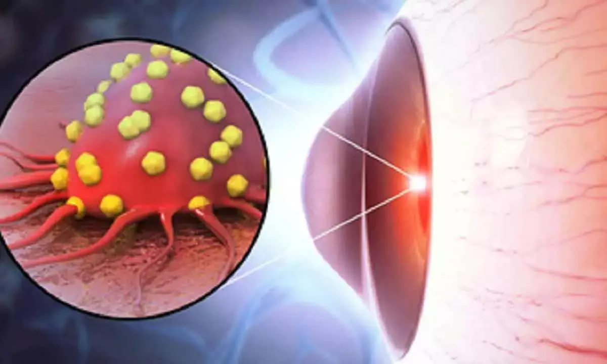 New Drug Delivery System Effective Against Rare Eye Cancer