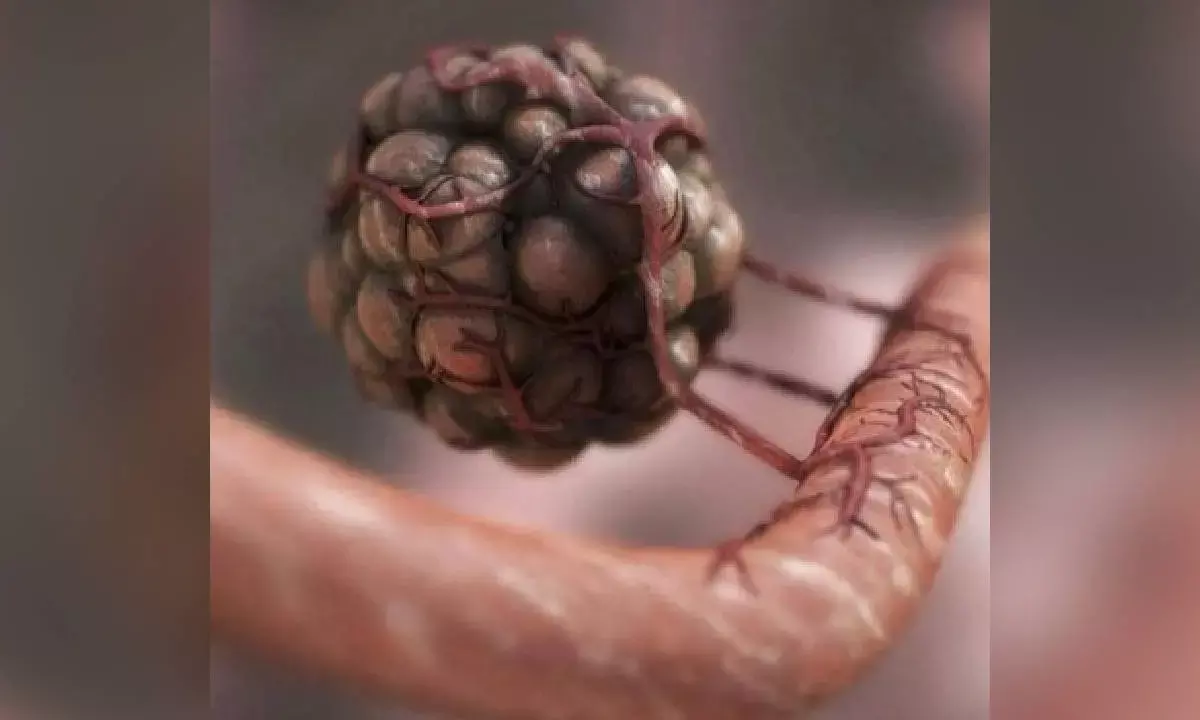 Researchers find genetic fingerprints to predict efficacy of immunotherapy