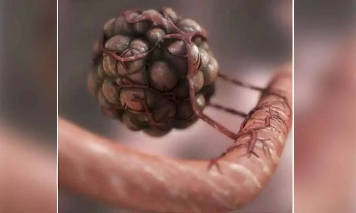 Genetic Fingerprints To Predict Efficacy Of Immunotherapy