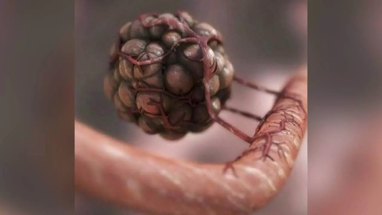 Researchers find genetic fingerprints to predict efficacy of immunotherapy Researchers find genetic fingerprints to predict efficacy of immunotherapy