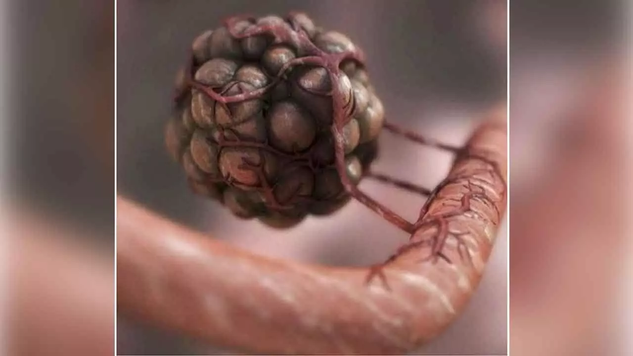 Genetic Fingerprints To Predict Efficacy Of Immunotherapy Genetic Fingerprints To Predict Efficacy Of Immunotherapy
