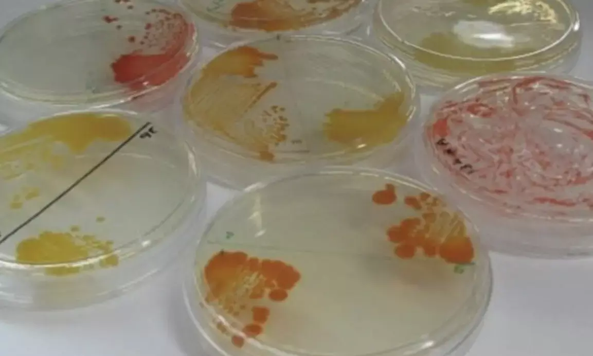 Are we dealing aliens? Scientists discover 26 new bacterial species in NASA’s sterile cleanrooms