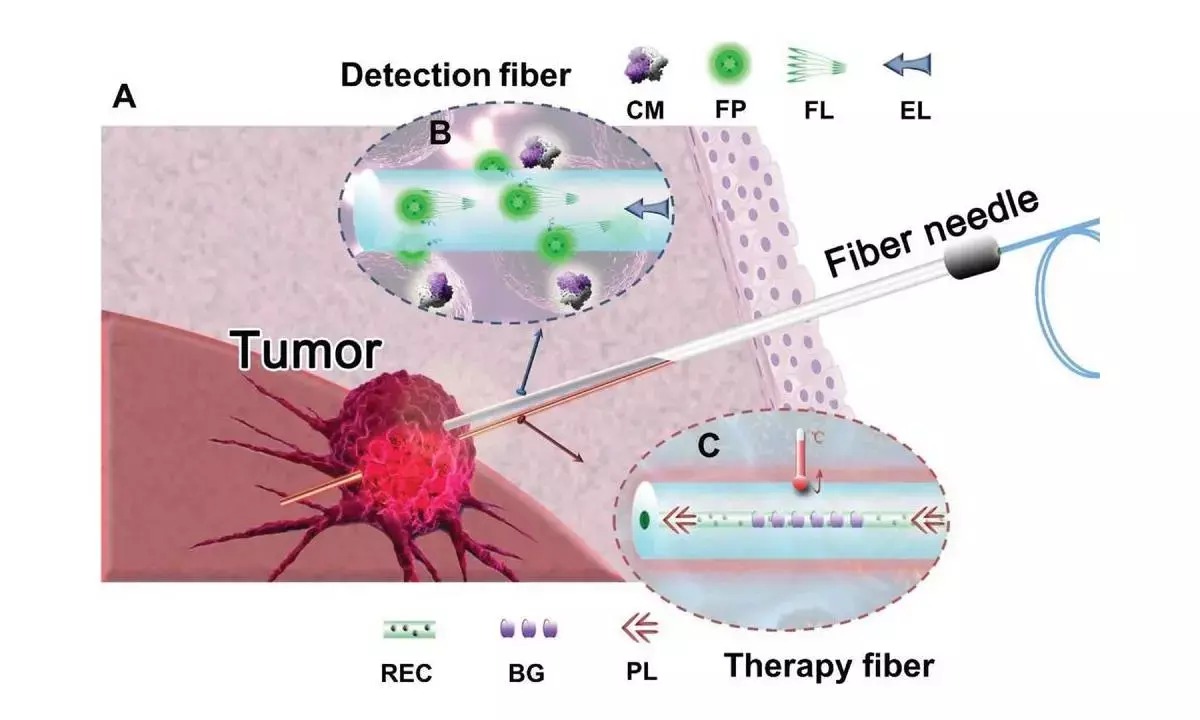 Cancer conquering optical fibres connecting us to a healthier future