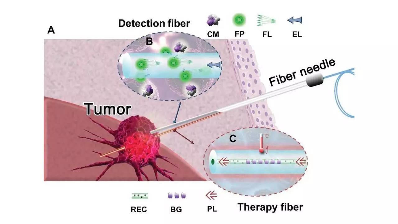 Cancer conquering optical fibres connecting us to a healthier future Cancer conquering optical fibres connecting us to a healthier future