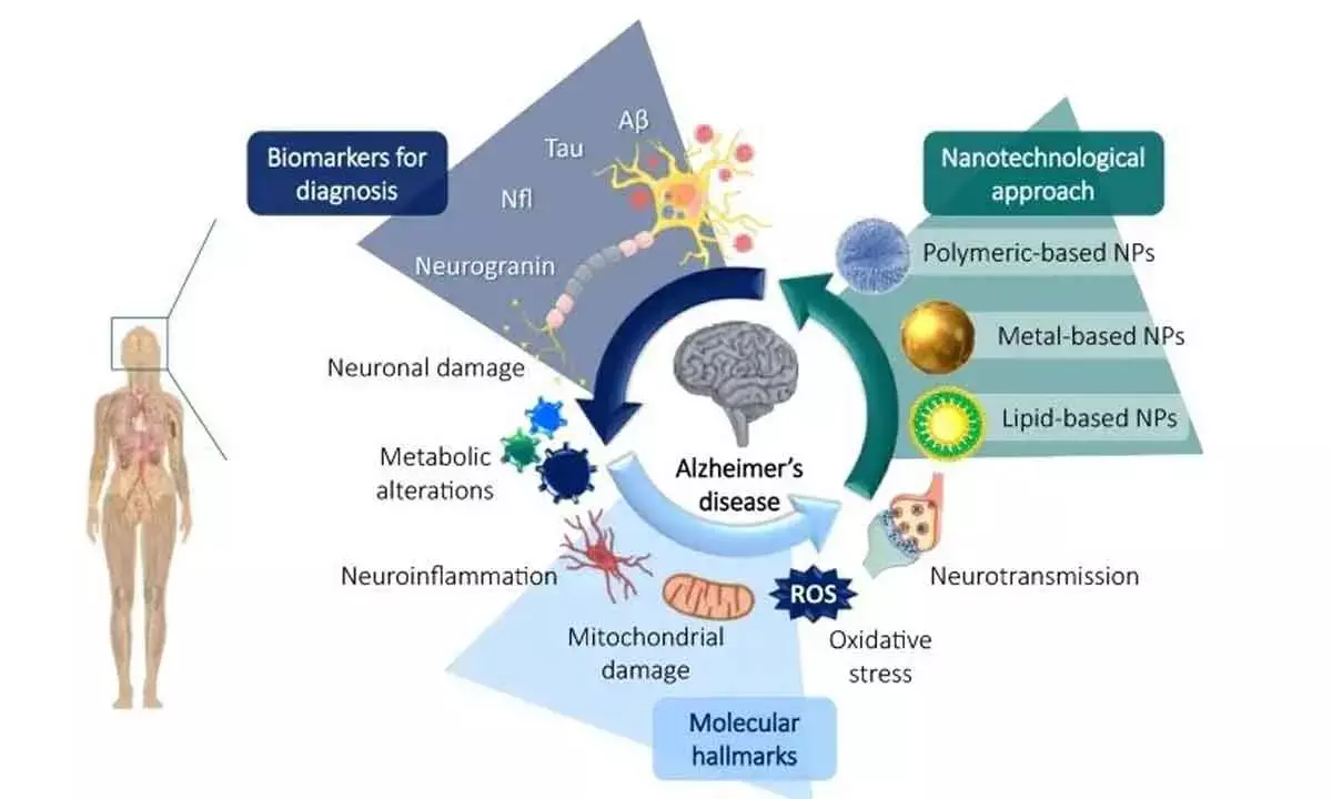 World Closer To Delivering Accurate Detection Of Alzheimers Disease That Betters Curative Treatment