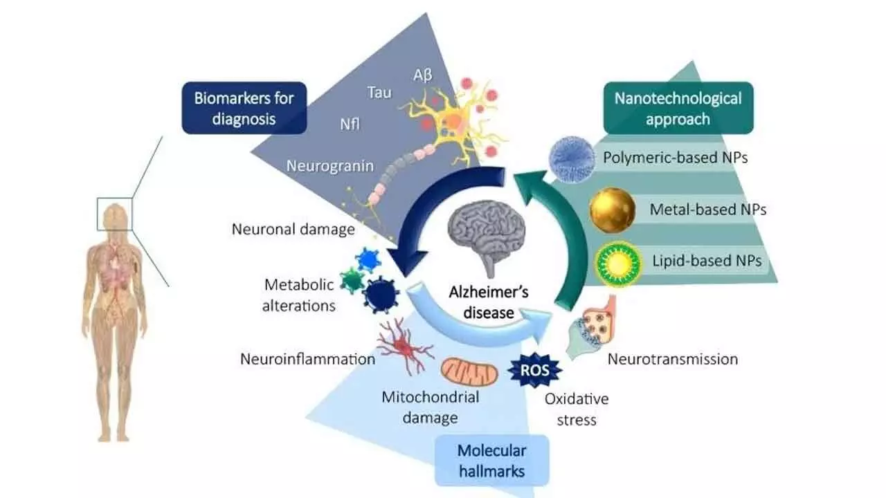 World Closer To Delivering Accurate Detection Of Alzheimers Disease That Betters Curative Treatment World Closer To Delivering Accurate Detection Of Alzheimers Disease That Betters Curative Treatment