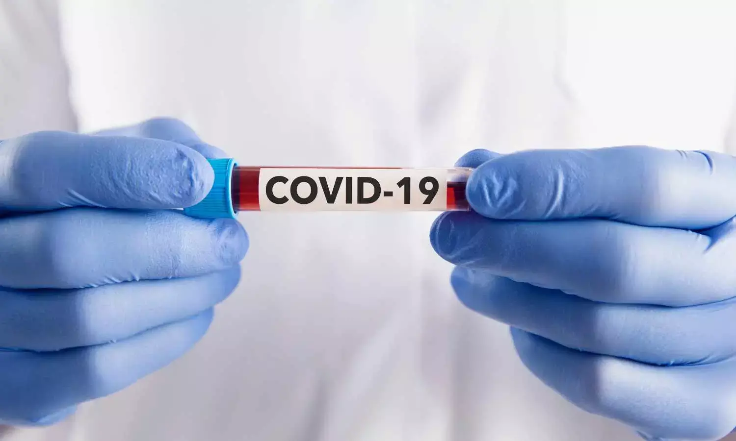 India Reports Surge in COVID Cases Amid Concerns Over Waning Immunity