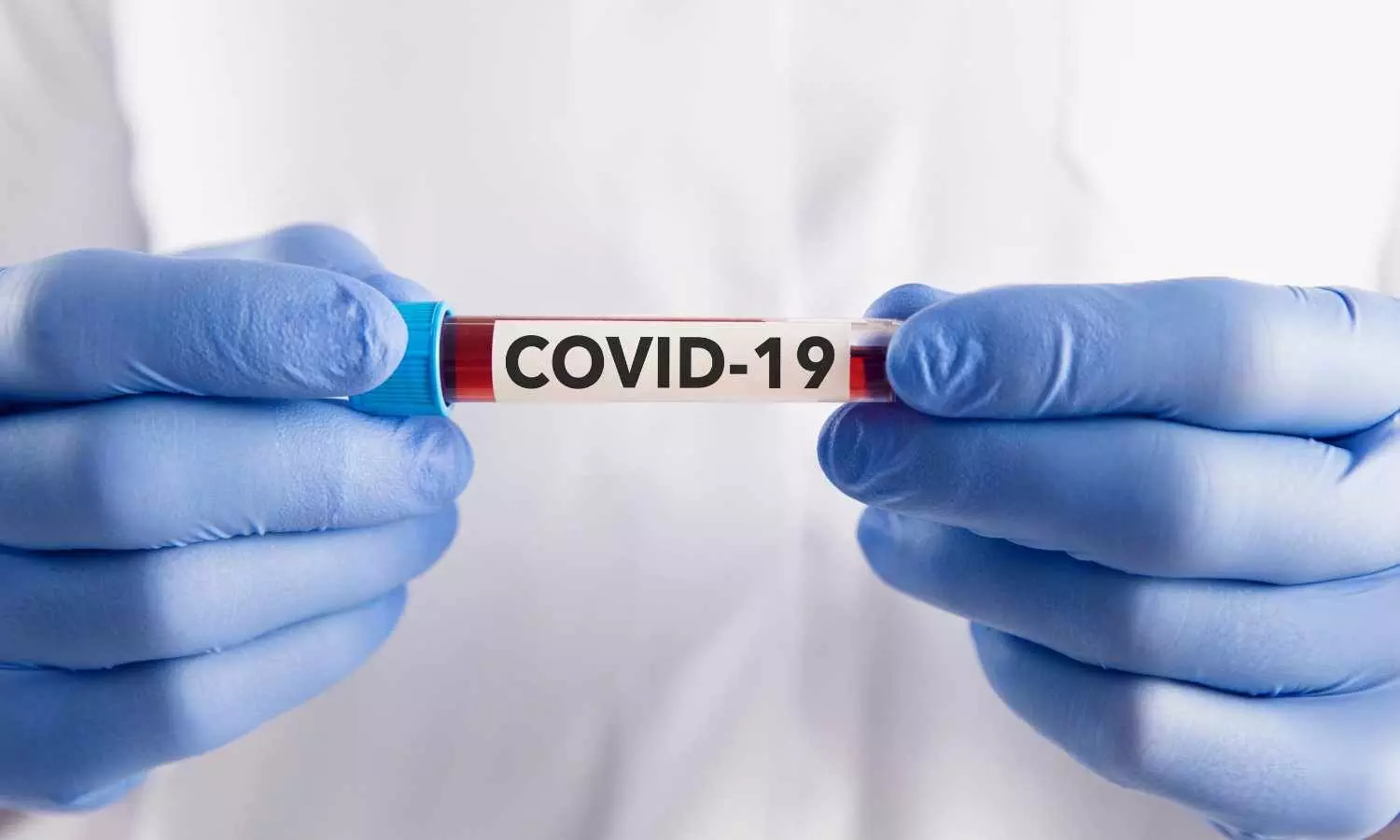 India Reports Surge in COVID Cases Amid Concerns Over Waning Immunity India Reports Surge in COVID Cases Amid Concerns Over Waning Immunity