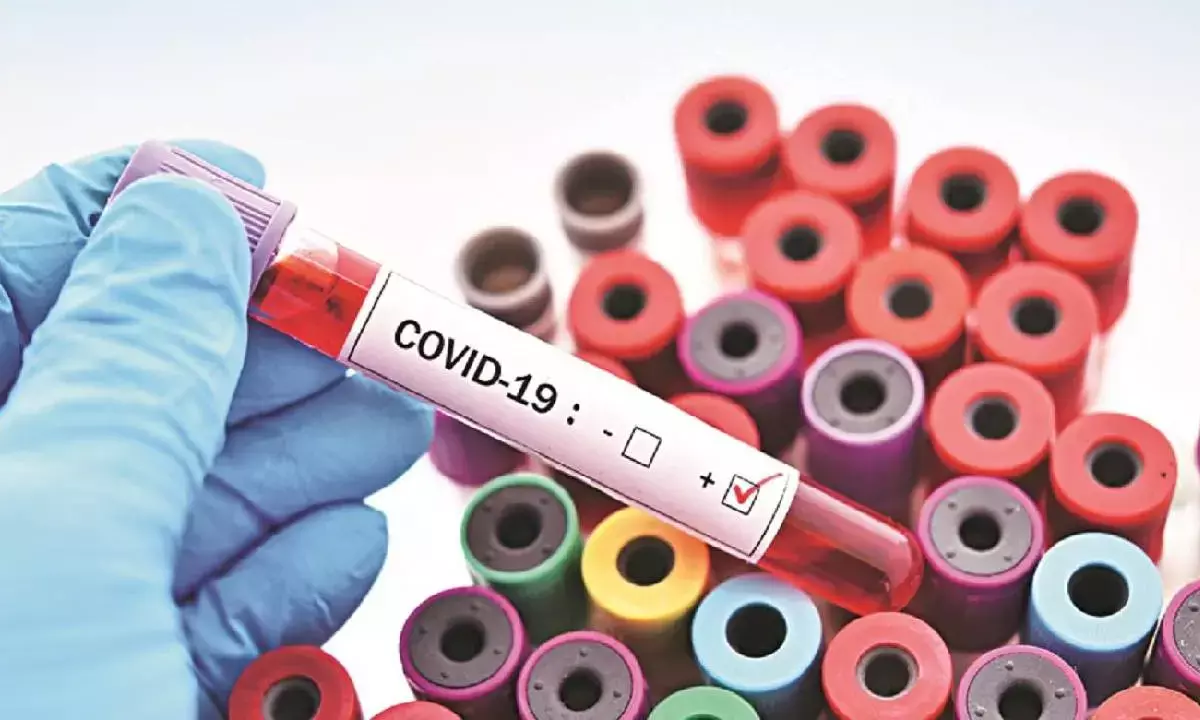Experts Reassure Public Amid COVID Uptick: No New Variants or Severe Cases Detected