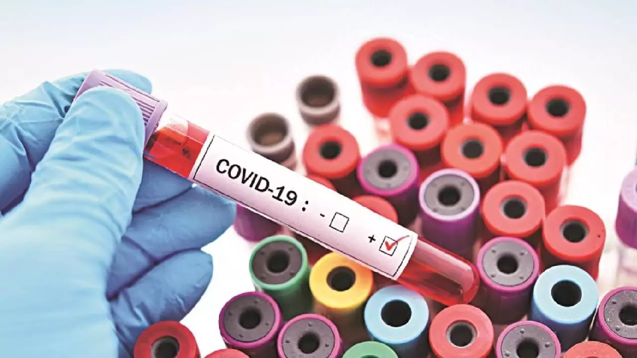 Experts Reassure Public Amid COVID Uptick: No New Variants or Severe Cases Detected Experts Reassure Public Amid COVID Uptick: No New Variants or Severe Cases Detected