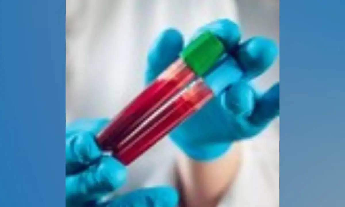 Book Lab Tests on Amazon App, Get Reports in 6 Hours