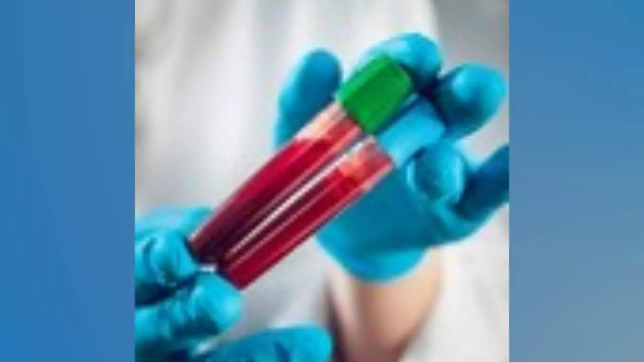 New blood test to rapidly diagnose thousands of rare genetic diseases in kids New blood test to rapidly diagnose thousands of rare genetic diseases in kids