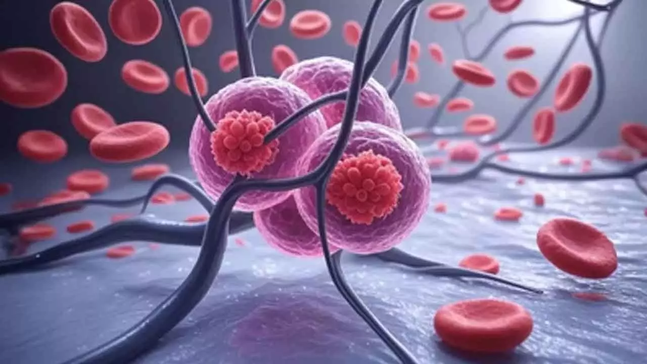 Study Links Global Warming To Rising Cancers Among Women Study Links Global Warming To Rising Cancers Among Women