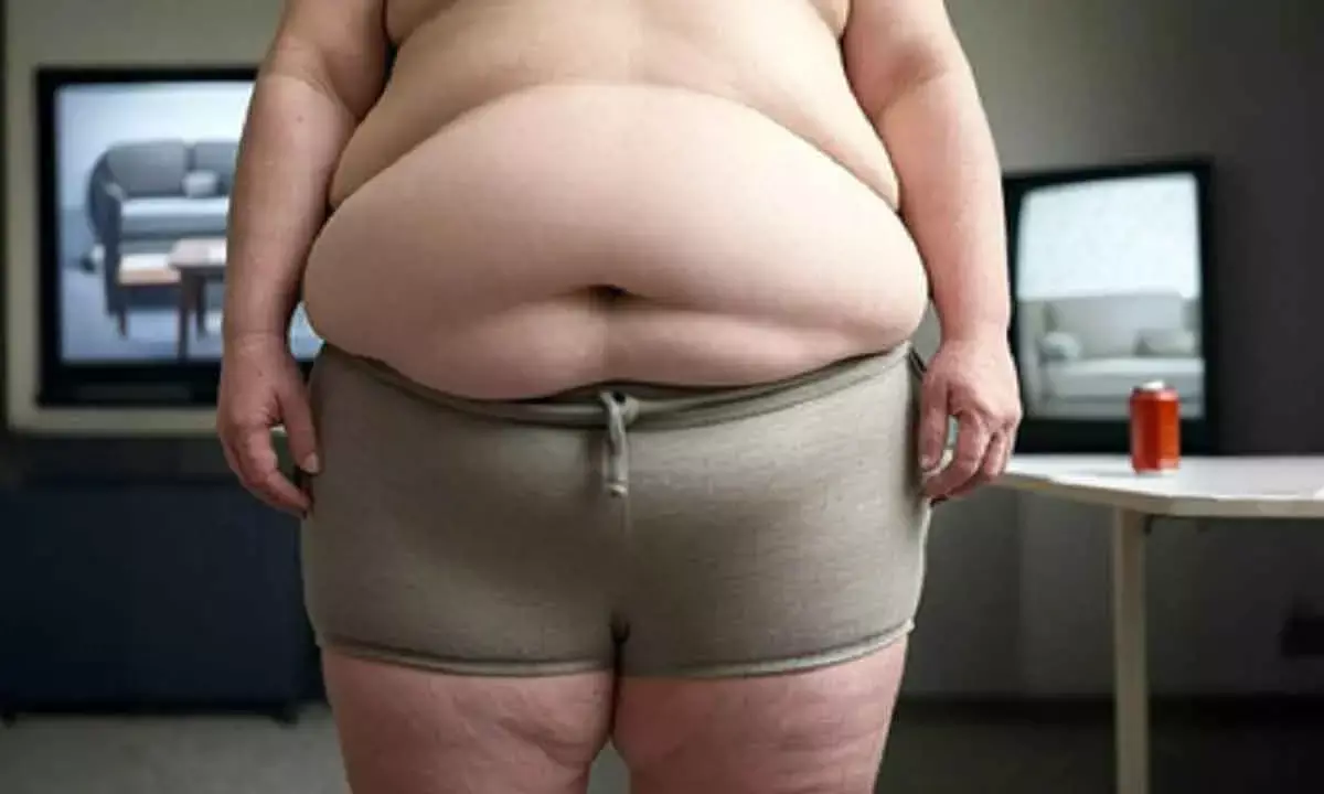 Obesity May Lead To Anxiety, Impair Brain Functioning: Study