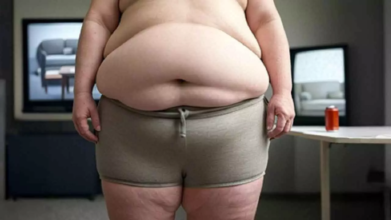 Obesity May Lead To Anxiety, Impair Brain Functioning: Study Obesity May Lead To Anxiety, Impair Brain Functioning: Study