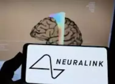 Neuralink Unveils Mind-Control Gaming with Sixth Brain Chip Implant, Astonishing the World Neuralink Unveils Mind-Control Gaming with Sixth Brain Chip Implant, Astonishing the World