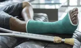 Fractured Plans: What Happens When You Break a Bone on a Business Trip Abroad?