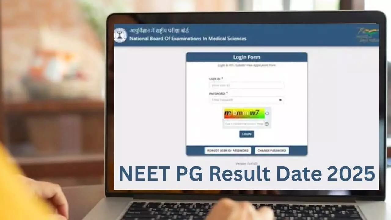 NEET PG 2025 Result Expected Between August 20–21: Scorecards to Be Available Soon on natboard.edu.in NEET PG 2025 Result Expected Between August 20–21: Scorecards to Be Available Soon on natboard.edu.in
