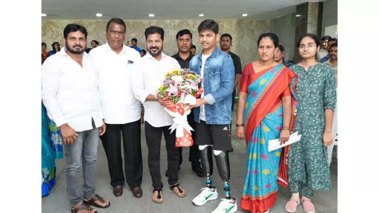 TG student who lost both legs after being pushed off train gets prosthetic limbs