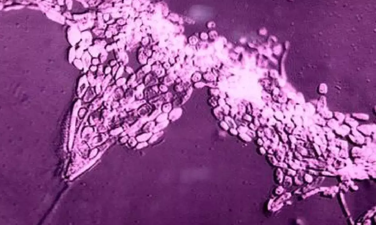 ICMR new approach to tackle fungal pathogens