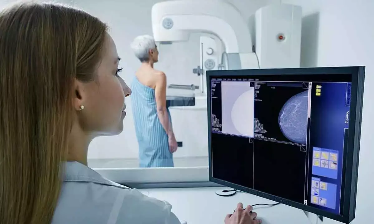 AI tool can know heart disease risk in women from mammogram, age: Research