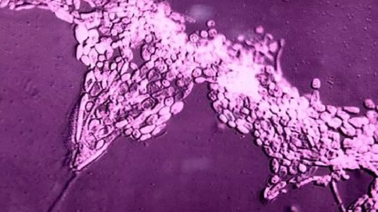 ICMR new approach to tackle fungal pathogens