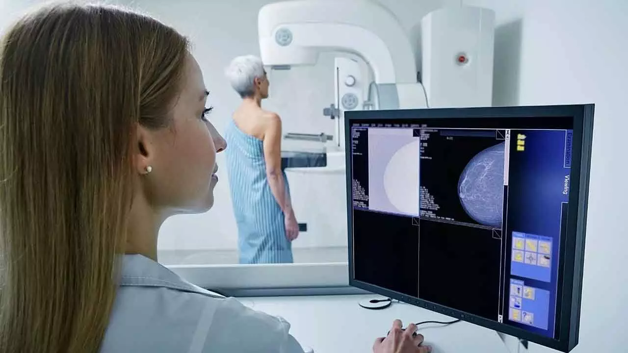 AI tool can know heart disease risk in women from mammogram, age: Research