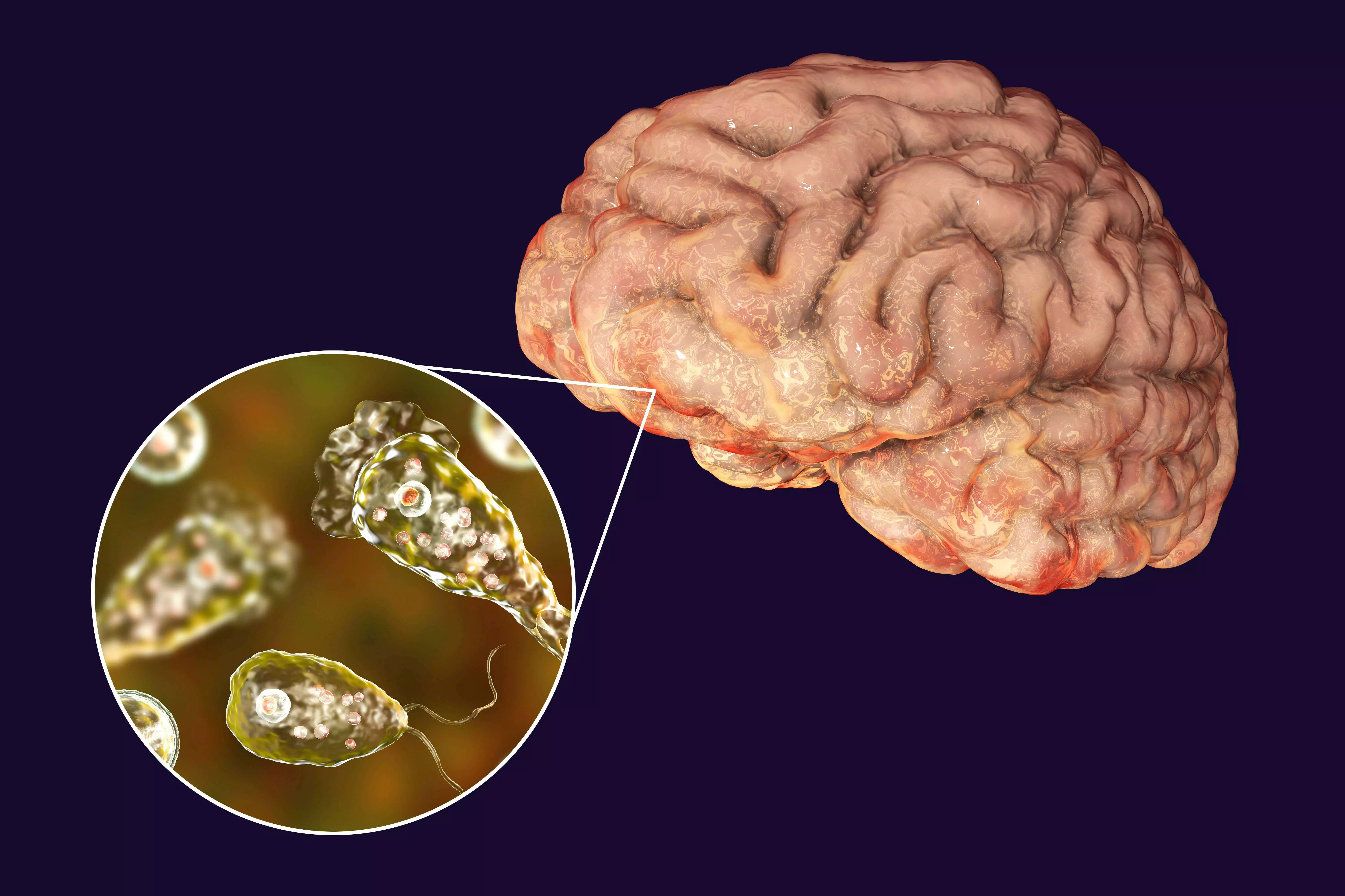 Kerala on Alert: 19 Dead from Brain-Eating Amoeba | Symptoms, Causes & Latest Updates