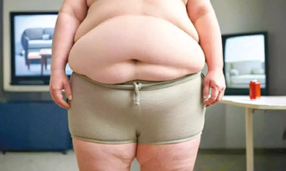 Severe obesity causes lungs to age prematurely: Study