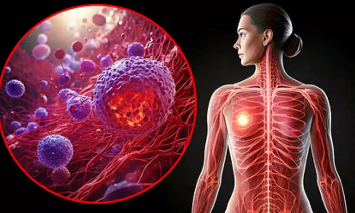 High-fat keto diet may drive breast cancer risk: Study