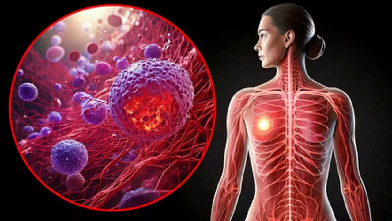 High-fat keto diet may drive breast cancer risk: Study High-fat keto diet may drive breast cancer risk: Study
