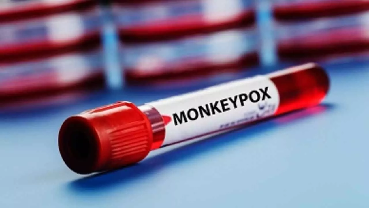 2,501 new mpox cases, 12 deaths reported from 44 countries in Oct: WHO