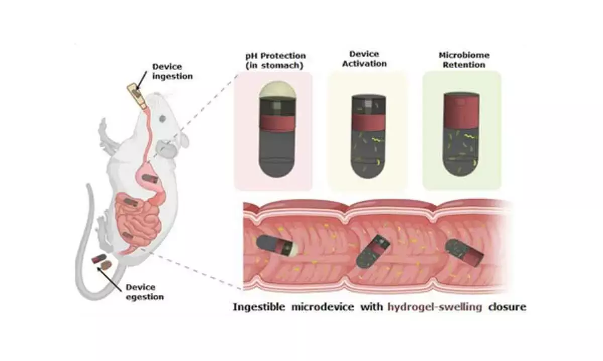 IIT Delhi, AIIMS’ new device can collect microbial samples from gut