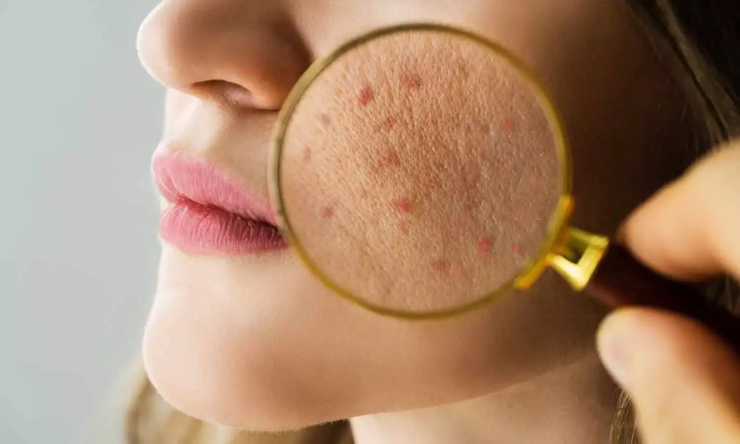 Say Goodbye to Holiday Breakouts with This Skin-Saving Fruit