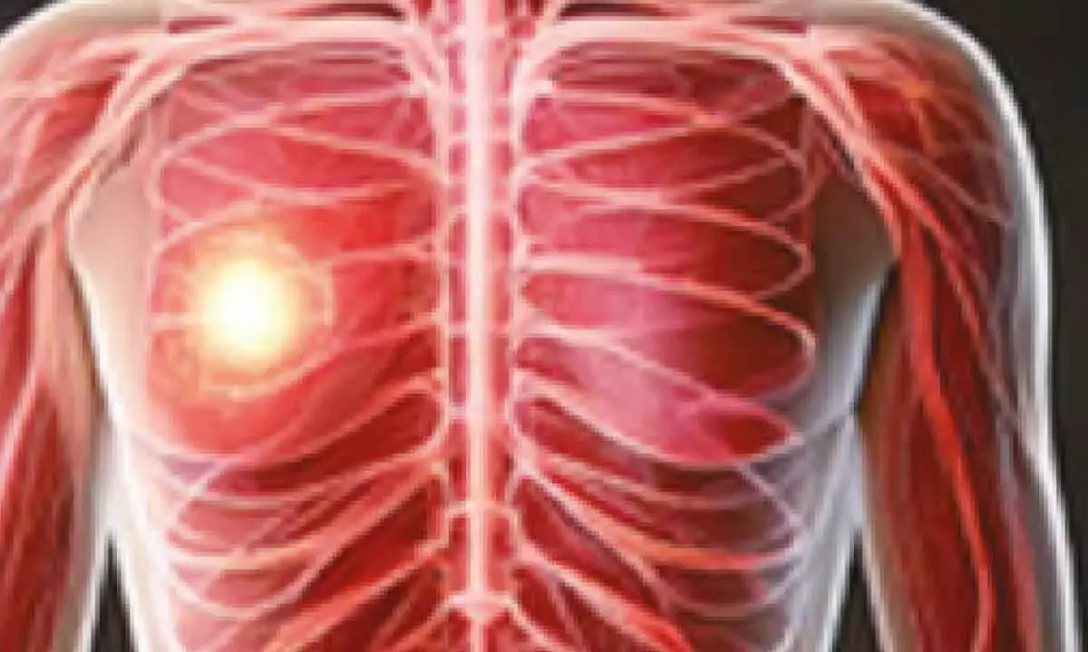 Disrupted sleep cycles linked to aggressive breast cancer: Study