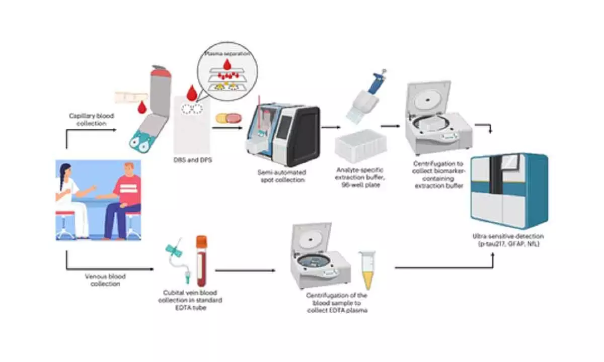 At-home blood tests can accurately detect key biomarkers of Alzheimers