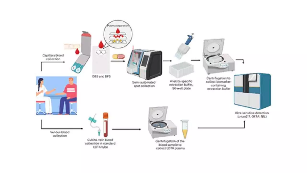 At-home blood tests can accurately detect key biomarkers of Alzheimers At-home blood tests can accurately detect key biomarkers of Alzheimers