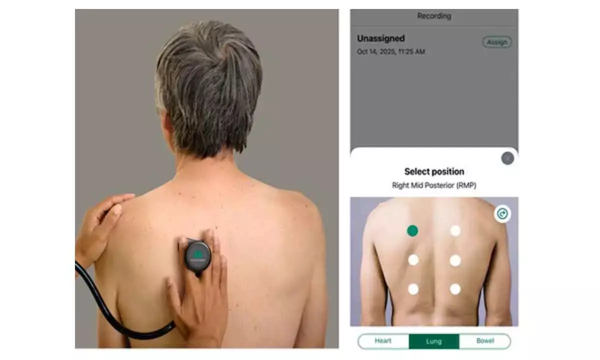 AI-powered digital stethoscopes show promise in bridging screening gaps