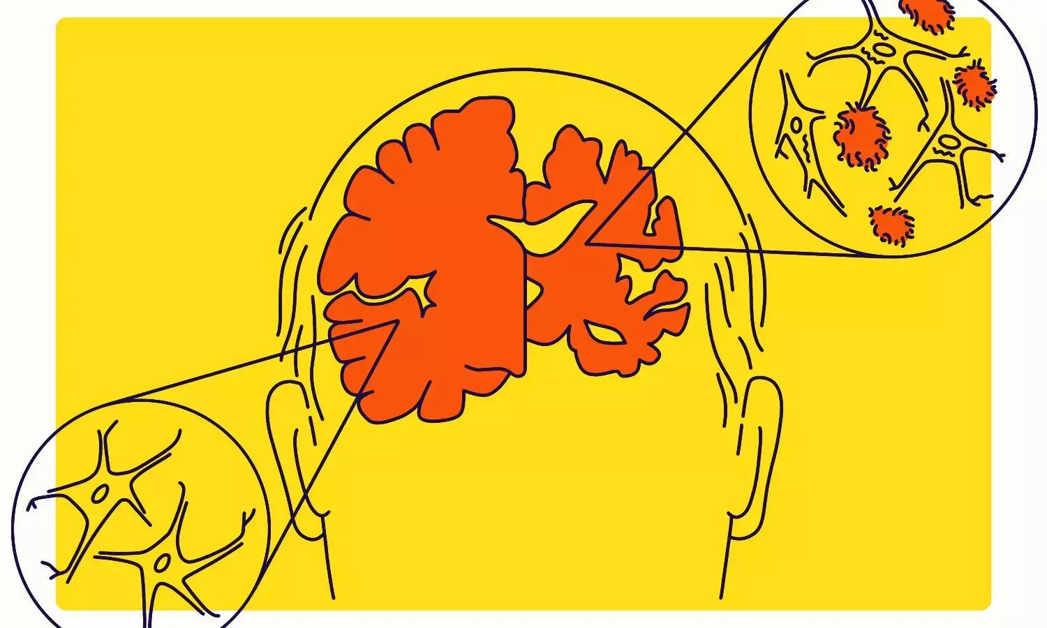 Regular exercise can assist liver protect the brain and fight Alzheimer’s, confirms new study